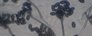 black-mold-stachybotrys-removal-nj